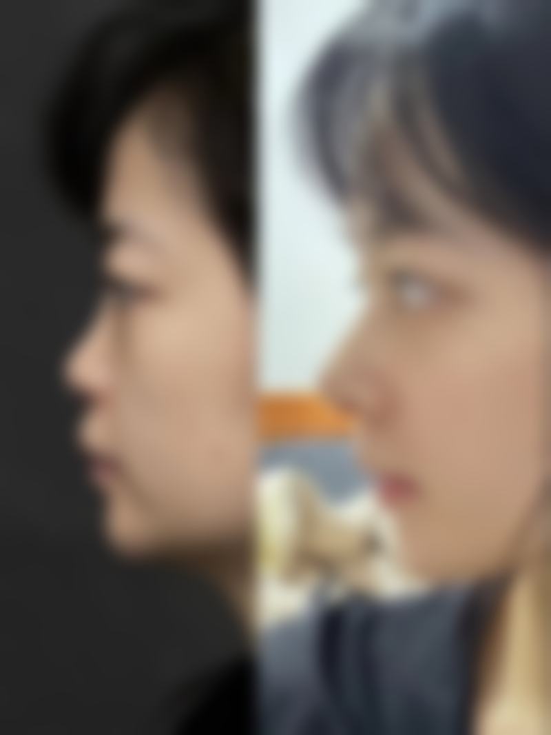 深圳美一度整形医疗美容门诊部真实患者评价