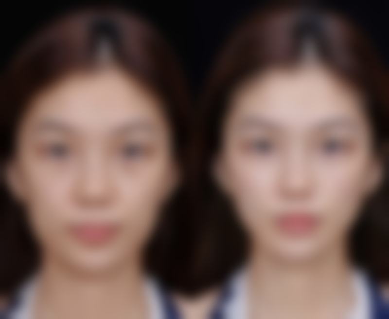 2026 佛山汇莹源医疗美容诊所项目价格参考
