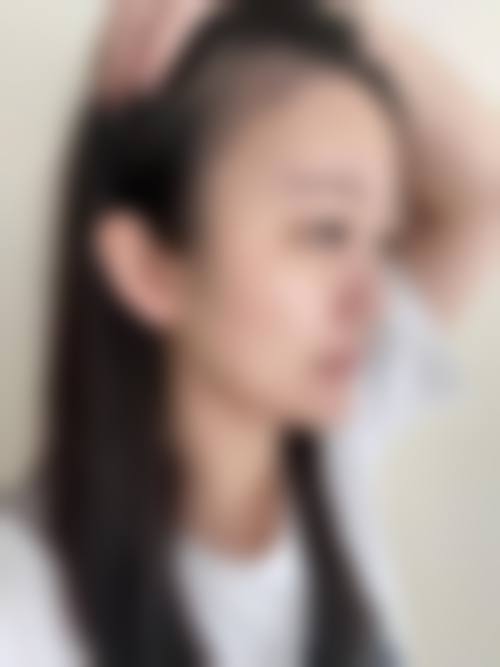扬州华美整形门诊部擅长项目有哪些？