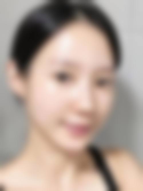 2026 韩国世涟皮肤科整形医院项目价格参考