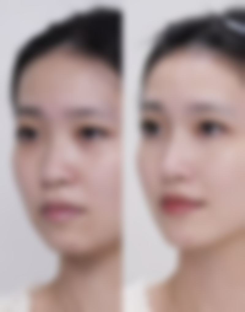 大连鑫锋医疗美容诊所擅长项目有哪些？
