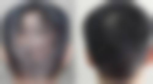 共立美容大宫东擅长项目有哪些？