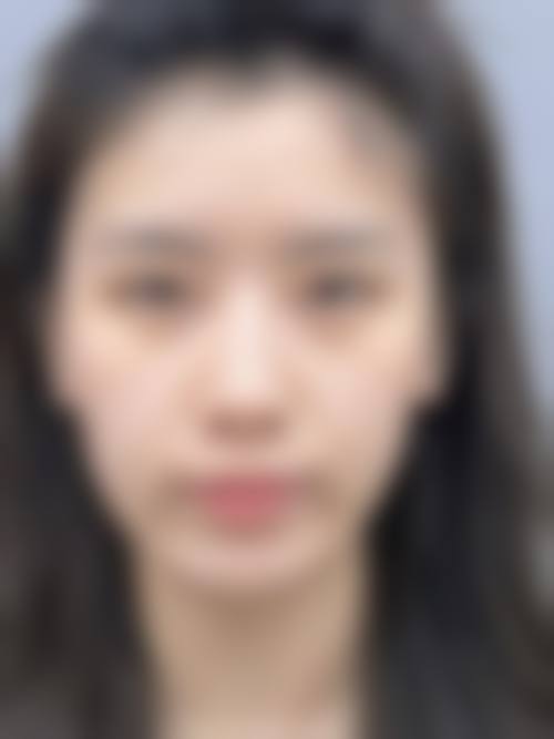 重庆非梵整形医院真实患者评价