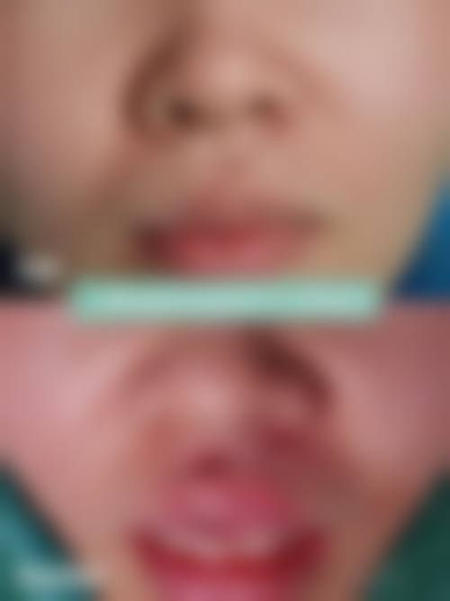 汕头妍妃梵医美门诊部交通路线及预约方式