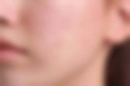 上饶饶美医疗美容门诊部真实患者评价