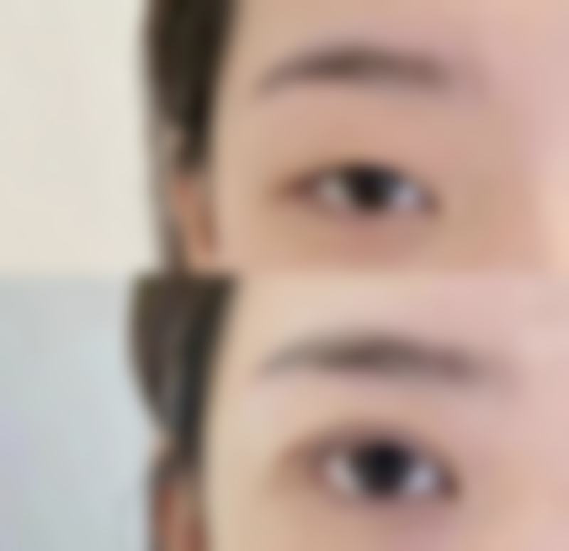 上饶饶美医疗美容门诊部擅长项目有哪些？