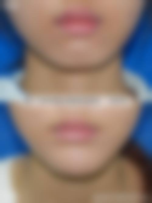 【重庆倾心医疗美容门诊部真实患者评价】