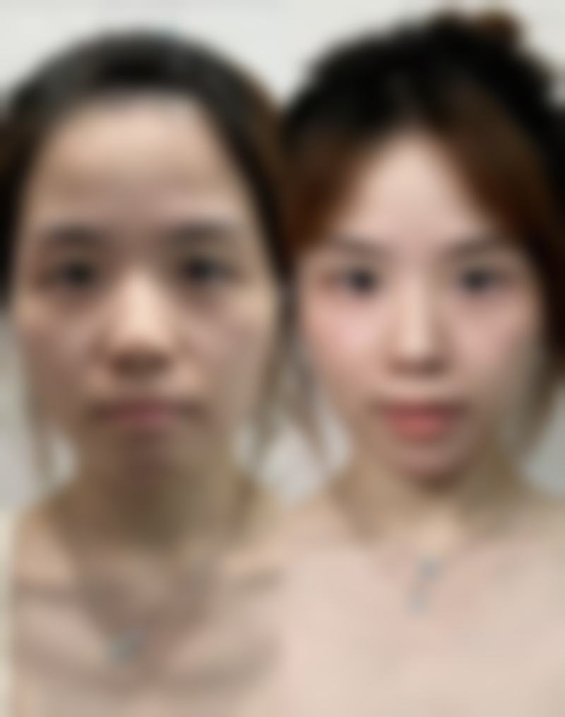 2026 广州广美美妍整形医疗美容门诊部项目价格参考