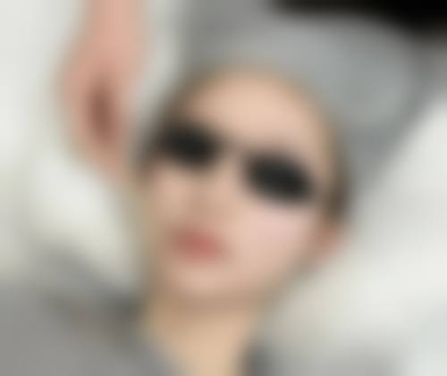 【渭南金郁医疗美容诊所真实患者评价】