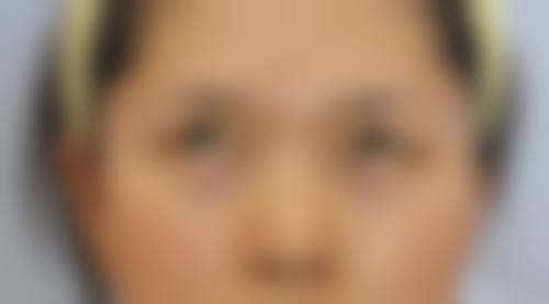 【益阳陈程医疗美容诊所医生团队】