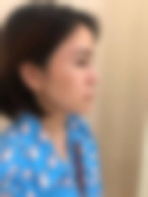 【徐州矿务集团总医院皮肤激光整形科真实患者评价】