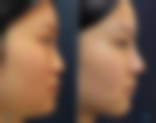 【2026湘南美容和歌山院项目价格参考】