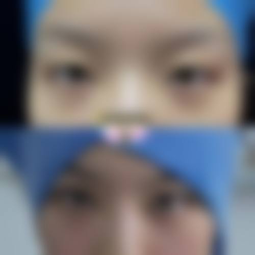 【重庆尼斯诗颜医疗美容诊所真实患者评价】