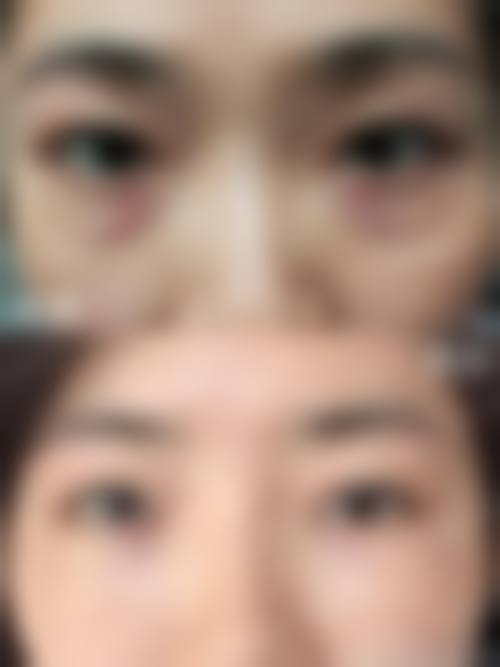 【2024丽水慈爱医院整形美容中 心项目价格参考】