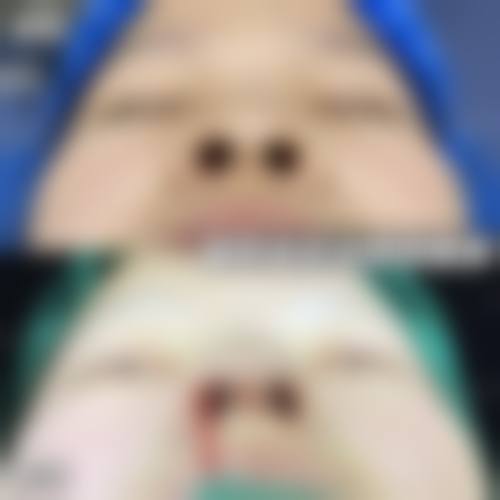 李海红擅长项目列表