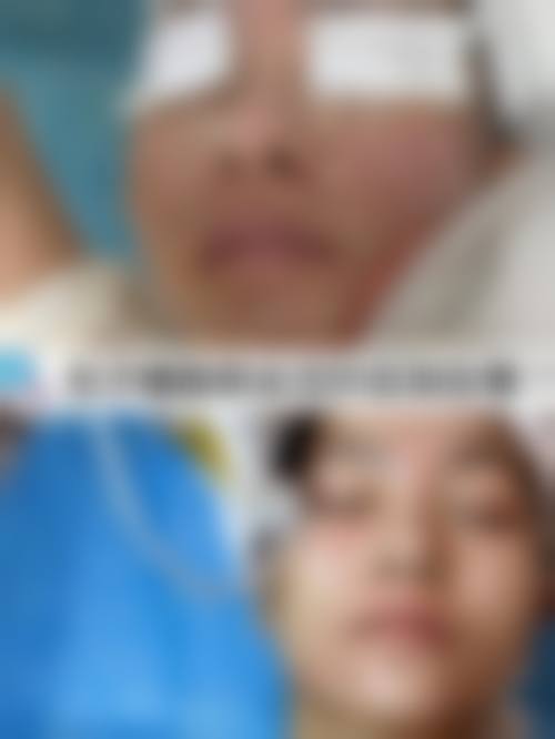 【2026宜春美人春整形医院项目价格参考】
