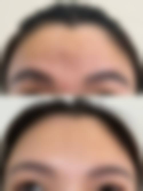 【丽水慈爱医院整形美容中 心真实患者评价】