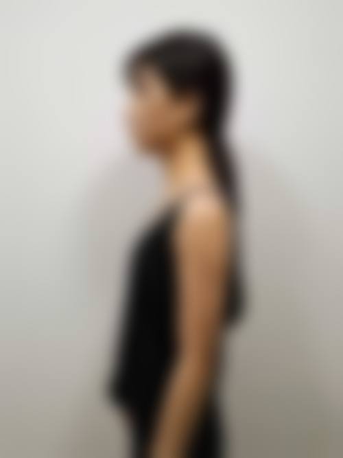 【2026 愿妃整形外科项目价格参考】