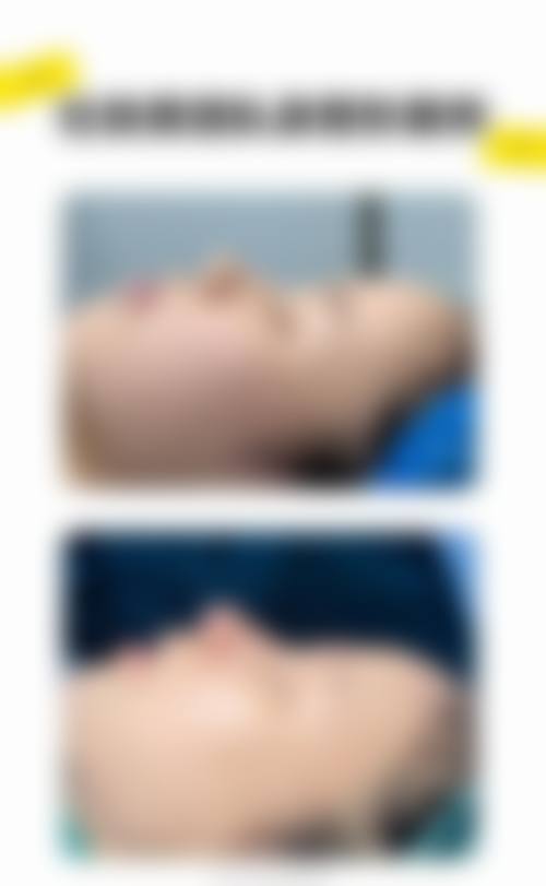【广州晨曦整形医院真实患者评价】
