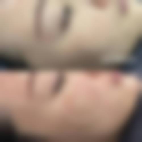 【海宁优嘉整形医院真实患者评价】
