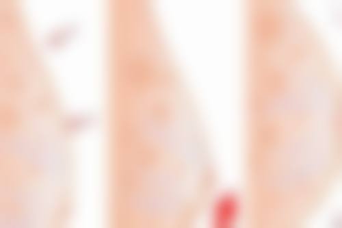 【淮南美橙整形外科门诊部真实患者评价】