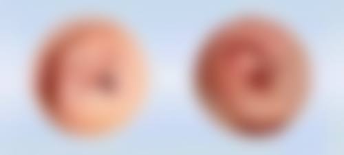【长沙中南大学湘雅医院医生团队】