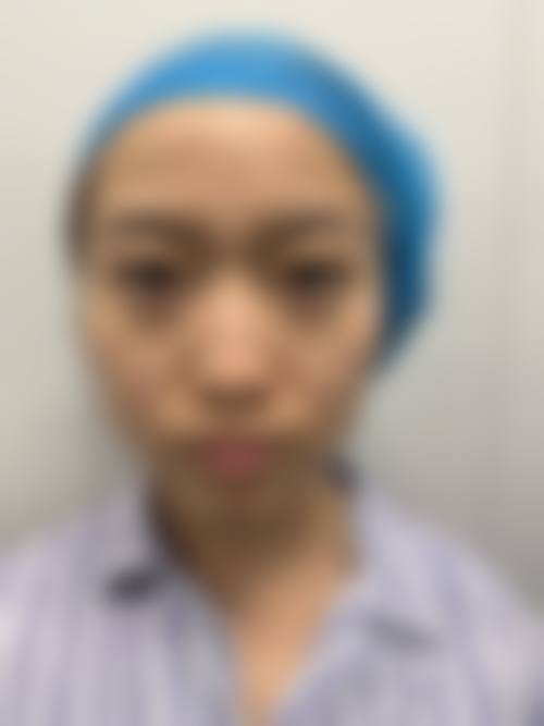 【2026青岛哥路博皛白净整形医院项目价格参考】