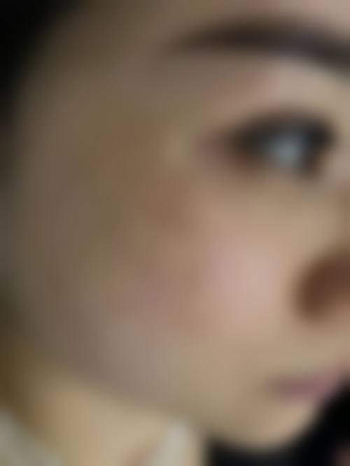 【北京伊蕾雅医疗美容诊所真实患者评价】