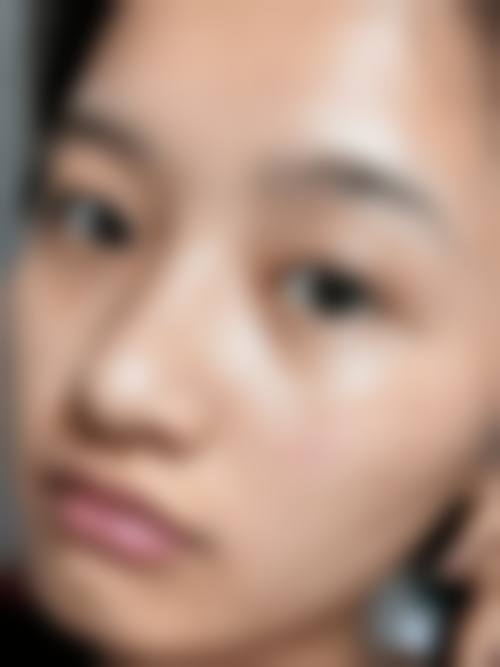 【韩国SINSA NO°5 CLINIC皮肤科擅长项目有哪些?】