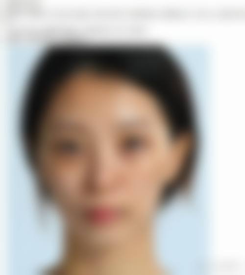 【北京伊蕾雅医疗美容诊所擅长项目有哪些?】