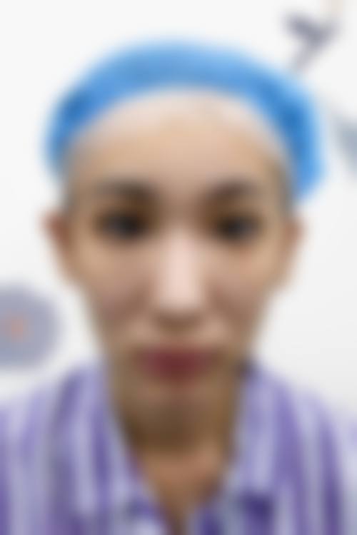 【辽阳刘刚医疗美容整形诊所擅长项目有哪些?】