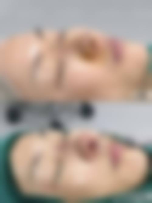 【2026西安嘉美丛臻(姬至臻)医疗美容门诊部项目价格参考】