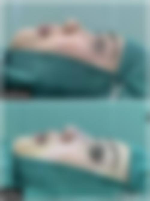 【西安嘉美丛臻(姬至臻)医疗美容门诊部真实患者评价】