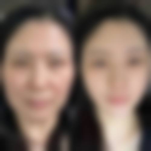 【韩国Dal:B整形外科擅长项目有哪些?】