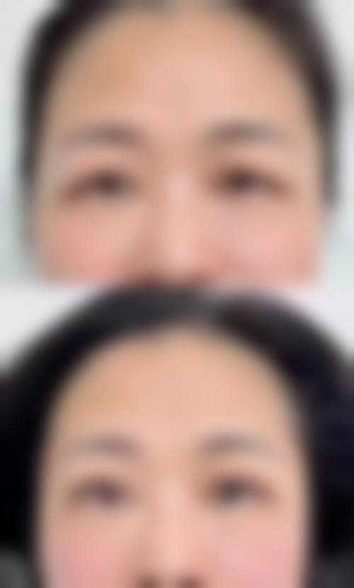 【2026韩国Dal:B整形外科项目价格参考】