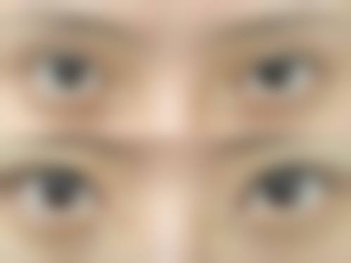 【银川百思美整形医学美容诊所真实患者评价】