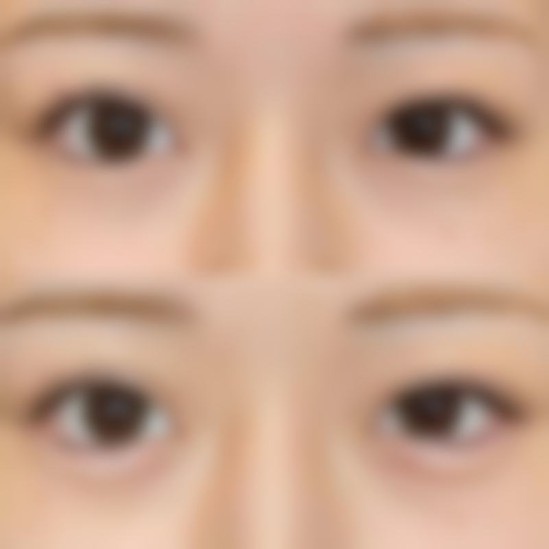 【银川百思美整形医学美容诊所擅长项目有哪些？】
