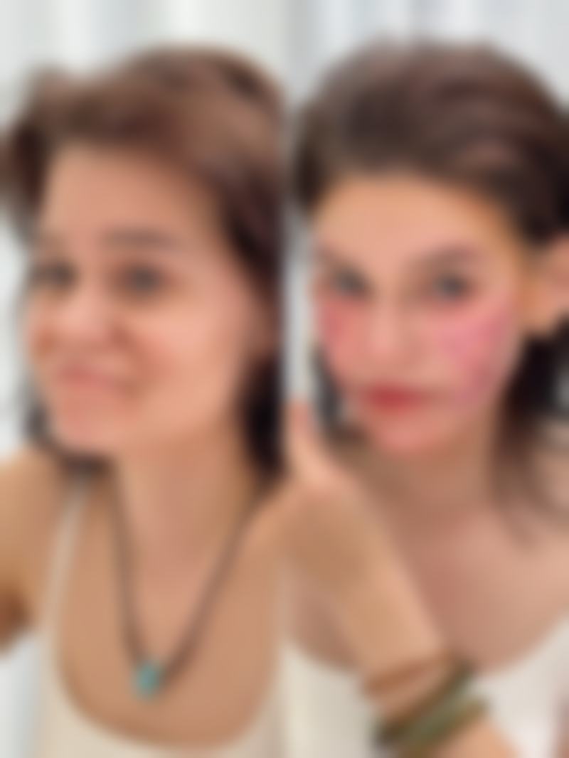 【滨城新美欣医疗美容门诊部真实患者评价】