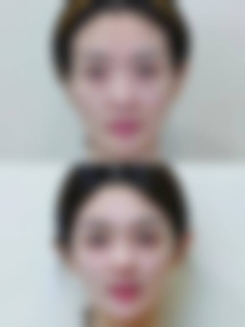 【2026广州维美整形医院项目价格参考】