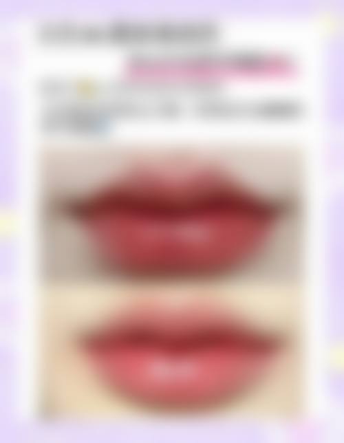 【临沂伊维美整形医院真实患者评价】