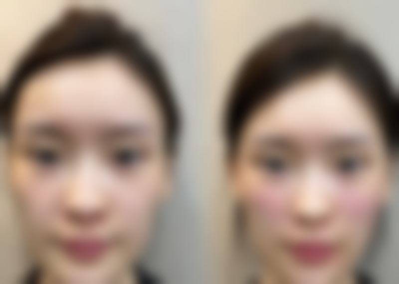 【深圳容恩医疗美容诊所真实患者评价】