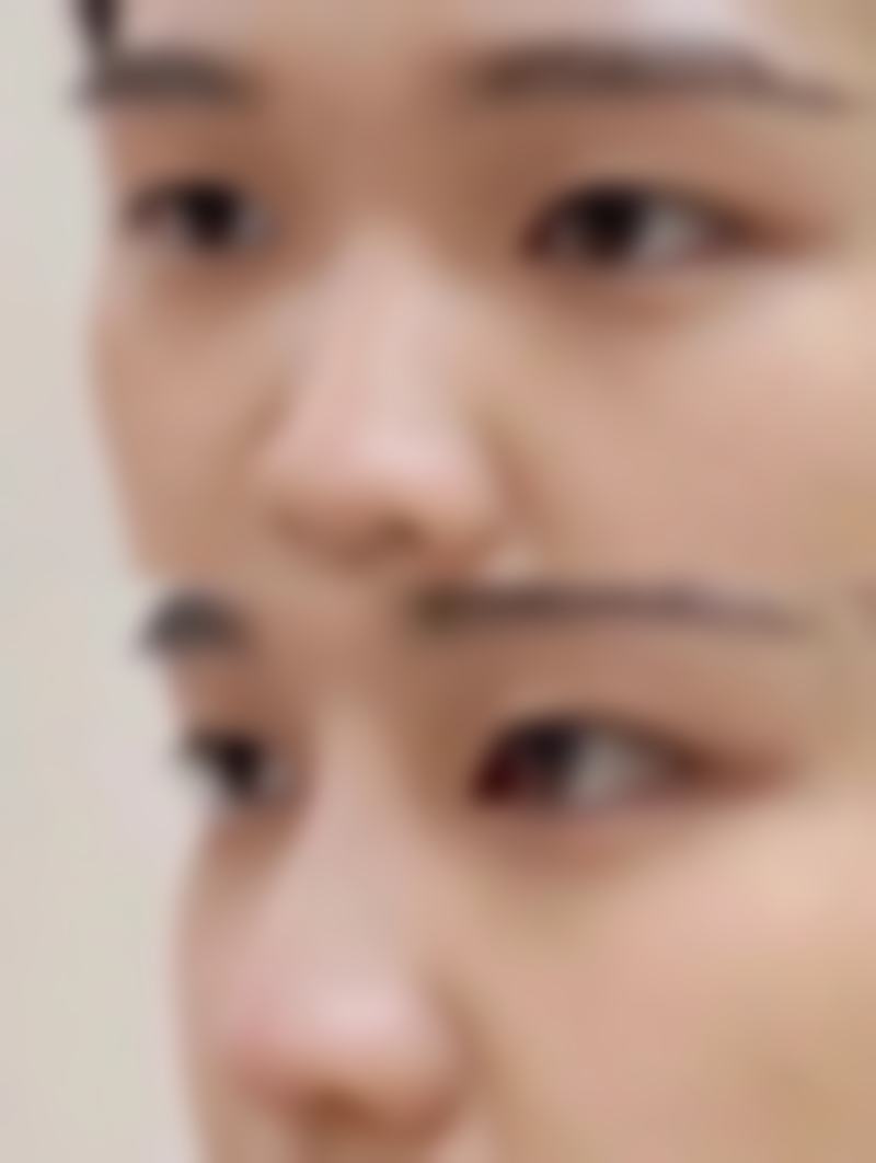 【临沂伊维美整形医院交通路线及预约方式】
