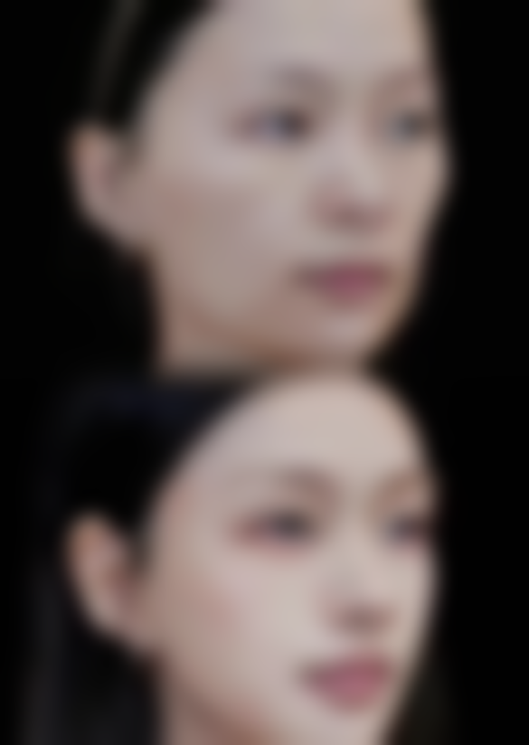 【杭州莱微医疗美容诊所真实患者评价】