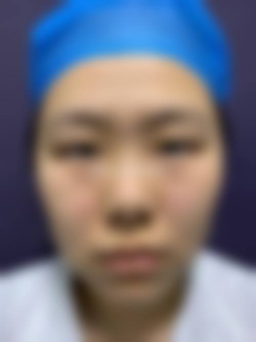 【北京思瑞医疗美容诊所真实患者评价】