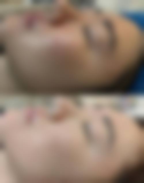 【北京思瑞医疗美容诊所擅长项目有哪些?】