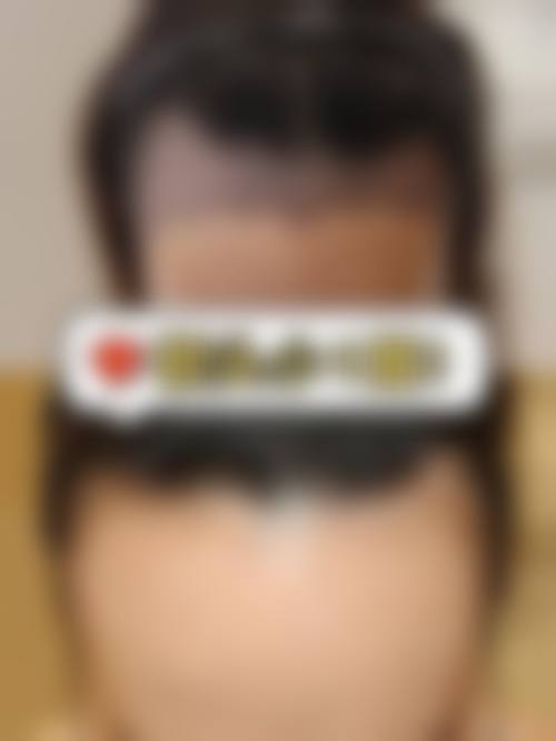 【湖南医药学院第一附属医院医疗美容科真实患者评价】