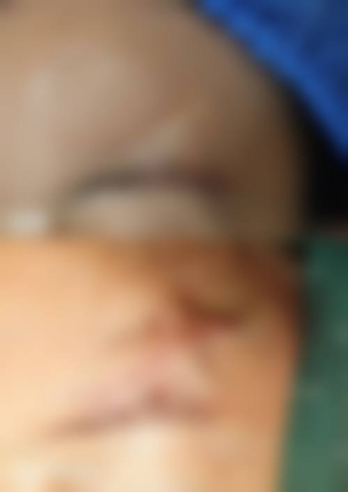 【承德铧中整形医院专精硬件保护诊疗安心】