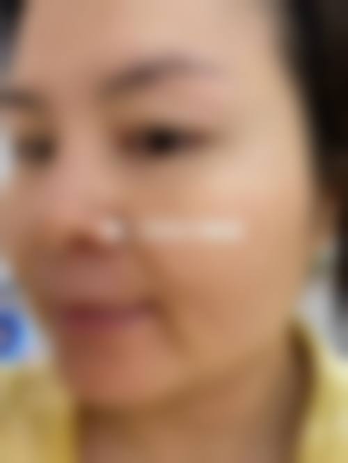 【重庆开州千黛医疗美容诊所真实患者评价】