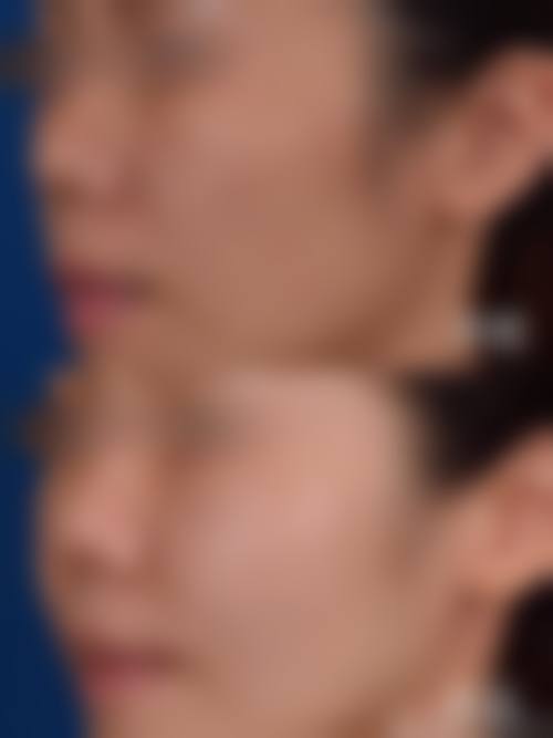 尹太俓荣誉