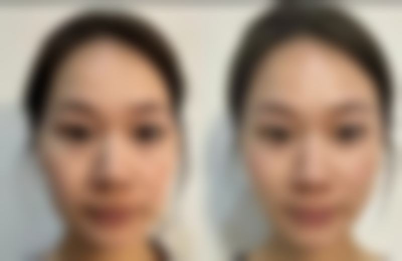 【南通启东顺势医疗美容真实患者评价】